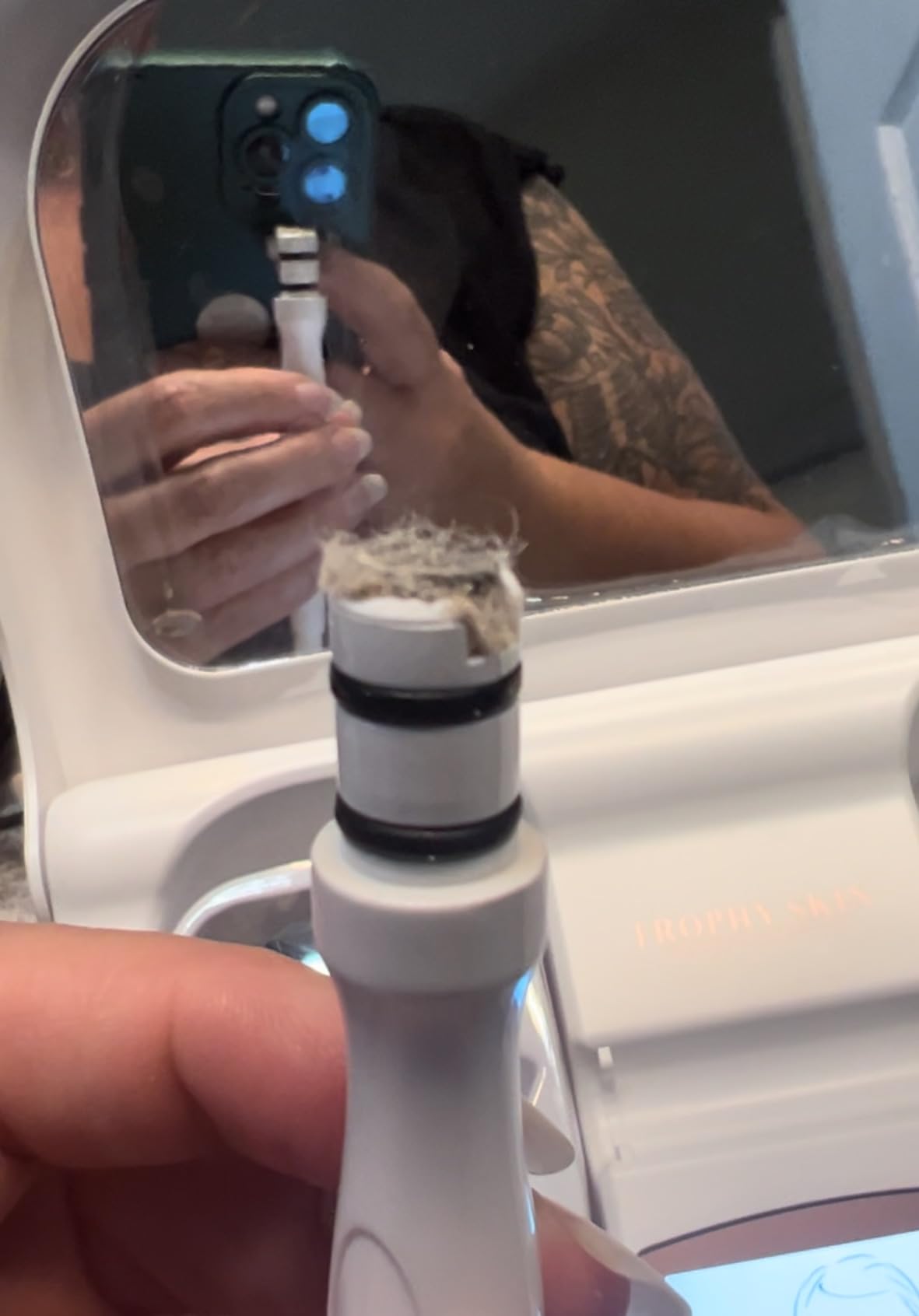 Trophy Skin MicrodermMD - At Home Microdermabrasion Kit - Anti Aging and Acne Treatment - Real Diamond and Pore Extractor Tips - White customer photo 1