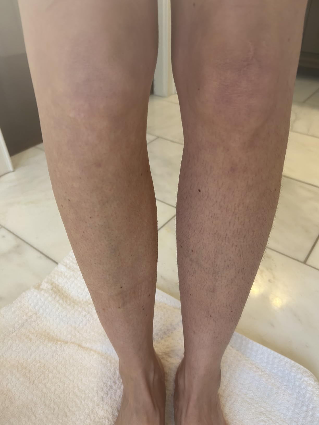 Philips Epilator Series 8000 for Women, with 3 Accessories, BRE700/04 customer photo 1