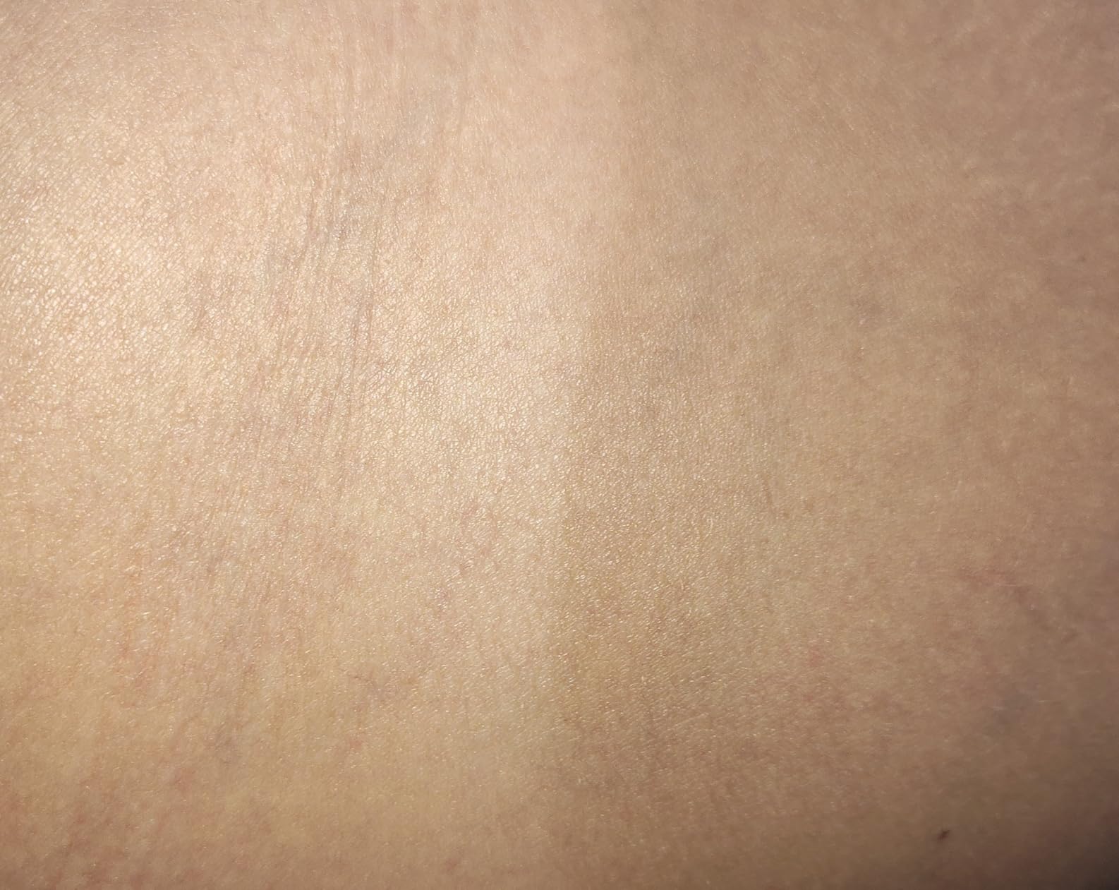 Ulike Laser Hair Removal Device Air 10 IPL Gift for Women and Men, Ice Cool and Permanent Hair Reduction for Nearly Painless, Dual Lights, Skin Sensor & USHR Mode Hair Removal in 10mins from Home customer photo 2