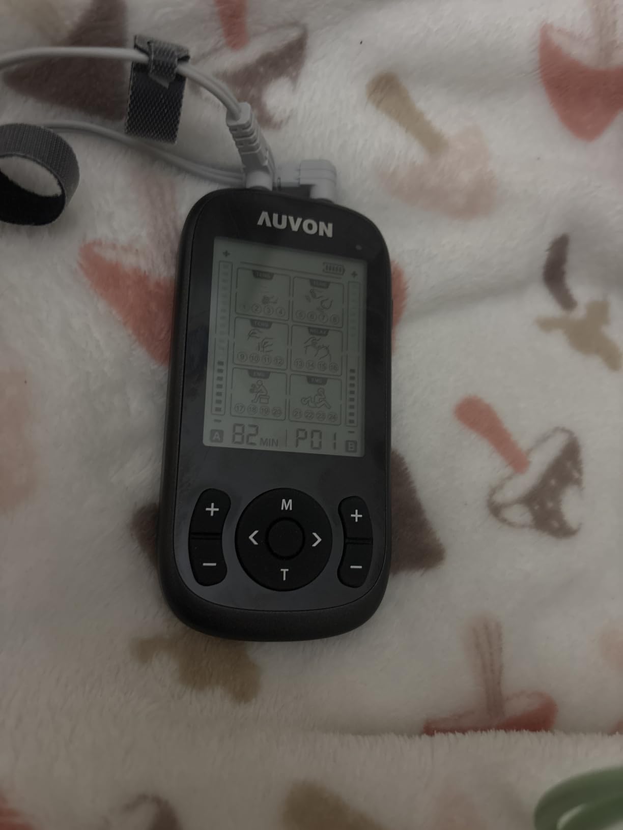 AUVON 3-in-1 TENS Unit Muscle Stimulator, 40 Levels for Gradual Pain Relief | EMS Massage Machine, Drug-Free for Shoulder, Sciatica, Back Pain Relief, 24 Modes Electronic Pulse Massager, 12 TENS Pads customer photo 1