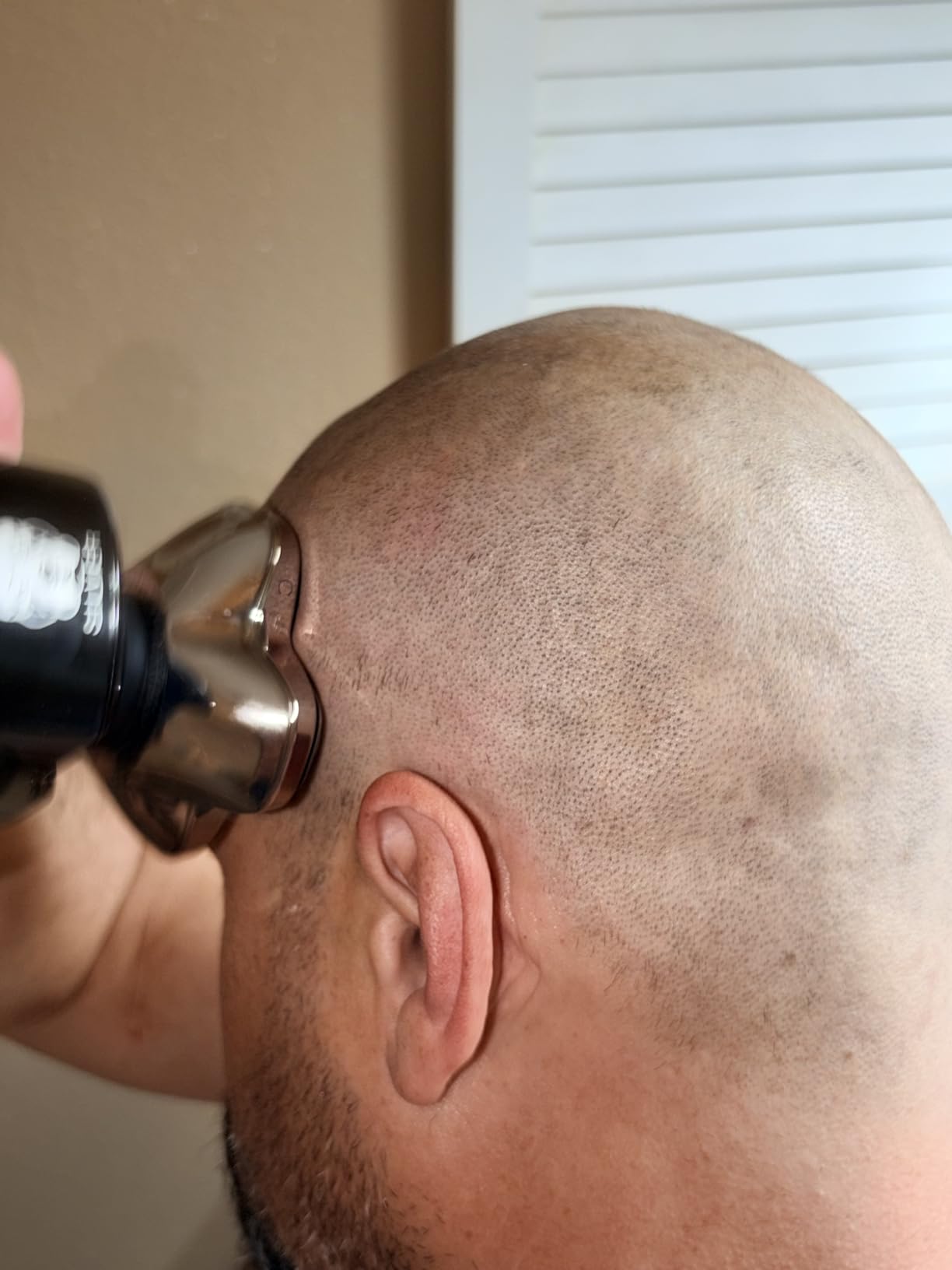 Skull Shaver Pitbull Silver PRO SX5 Head and Face Shaver, Cordless Razor customer photo 1