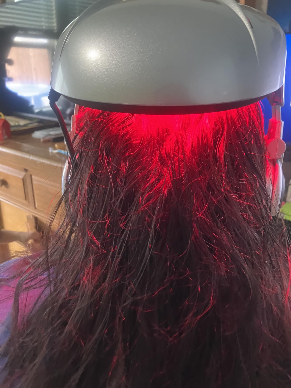 iGrow Laser Hair Growth System - Red Light Helmet Therapy, Clinically Proven, FDA Cleared Laser Cap Hair Growth for Men & Women customer photo 1