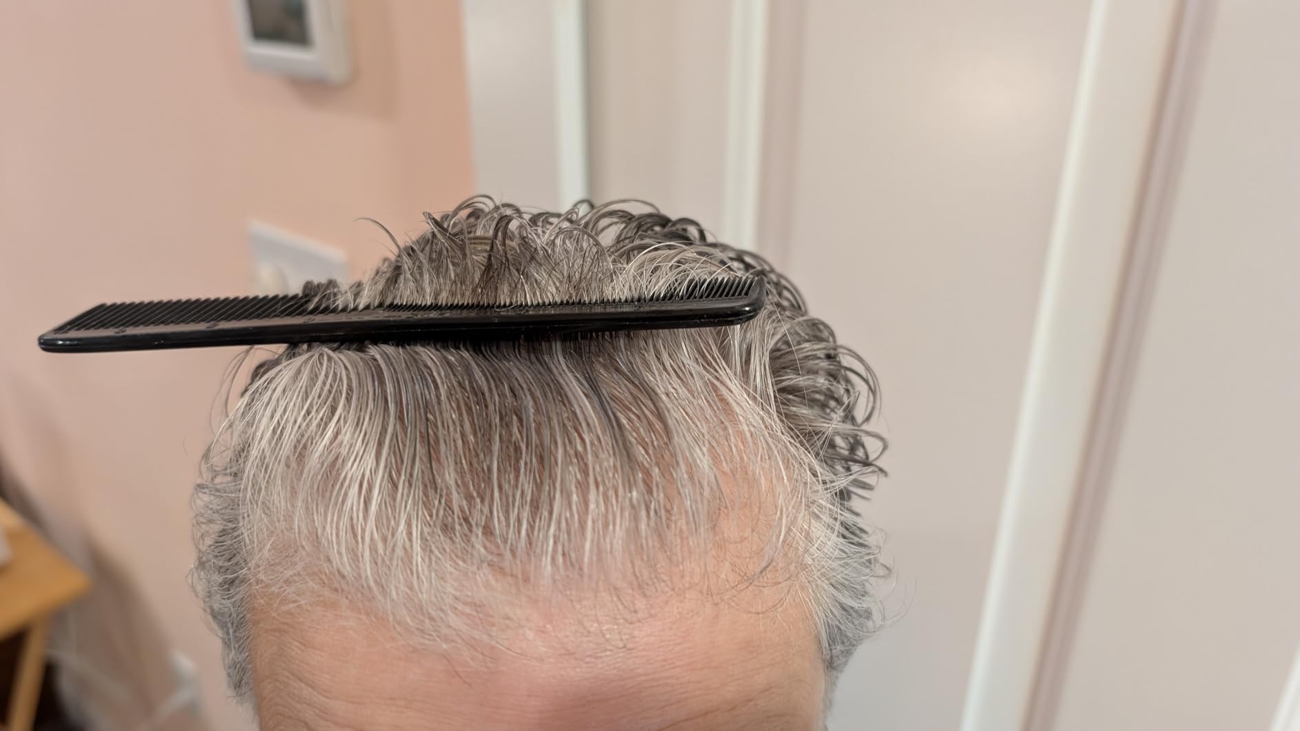 illumiflow 272 Laser Cap for Hair Growth - FDA Cleared Low Level Laser Therapy Hair Regrowth System for Men & Women - Hair & Scalp LLLT Hat w/Lasers Stops Hair Loss & Regrows Thinning Hair customer photo 1