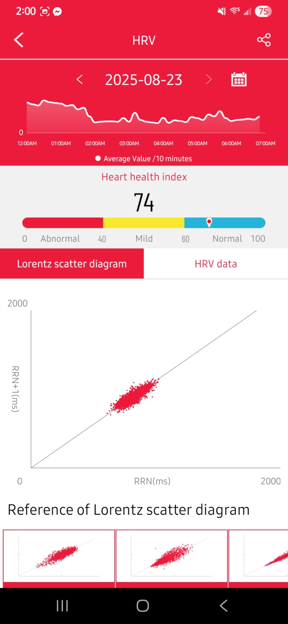Advanced Health Smartwatch for Women Men with Real-Time Monitoring of Heart Rate, Blood Oxygen, Body Temperature, Blood Pressure, Sleep Auality and Stress Levels.Always-On Display, for Android & iOS customer photo 1